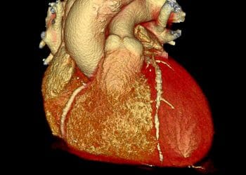 Yeni Tekrar Düzenleme Tedavisi Küçük Bir Çalışmada Tehlikeli Kolesterol Düşürüyor