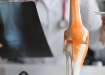 Kemik Sıhhati Için Beslenme Rehberi: Hangi Besinler Yararli, Hangileri Ziyanli?